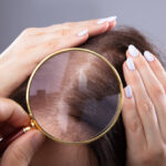 Trycholog – czyli jak przebiega leczenie wypadających włosów